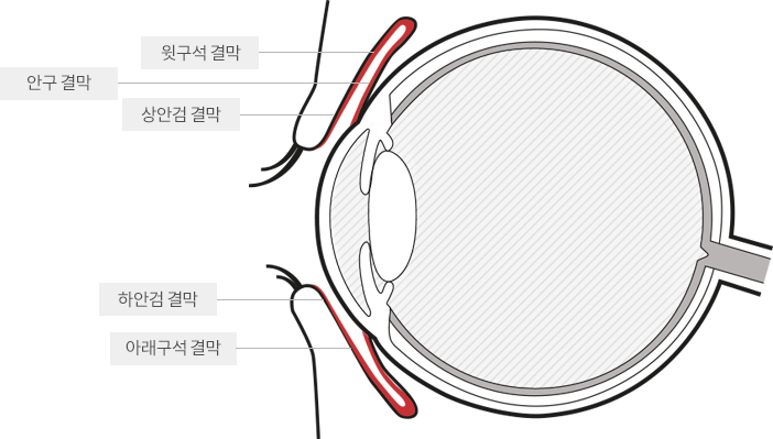 결막이란